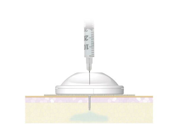 Инъекционный порт i-Port Advance Medtronic 6 мм - Image 2