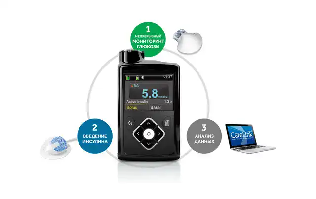 Инсулиновая помпа Medtronic Minimed 640G - Зображення 4