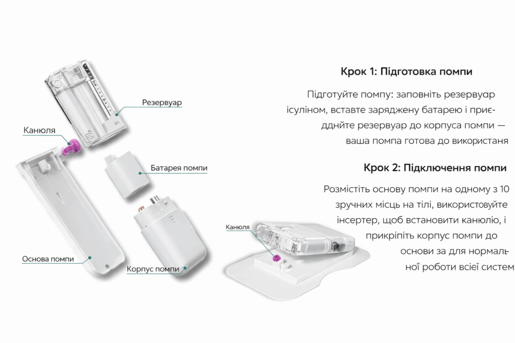 Схема інсулінової помпи та її компонентів