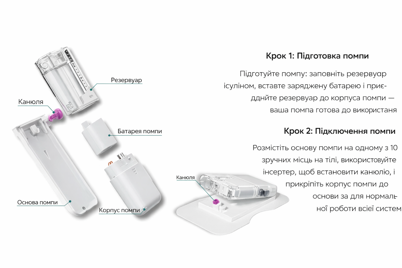 Схема інсулінової помпи та її компонентів